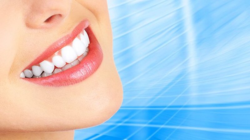 Teeth Bleaching Services